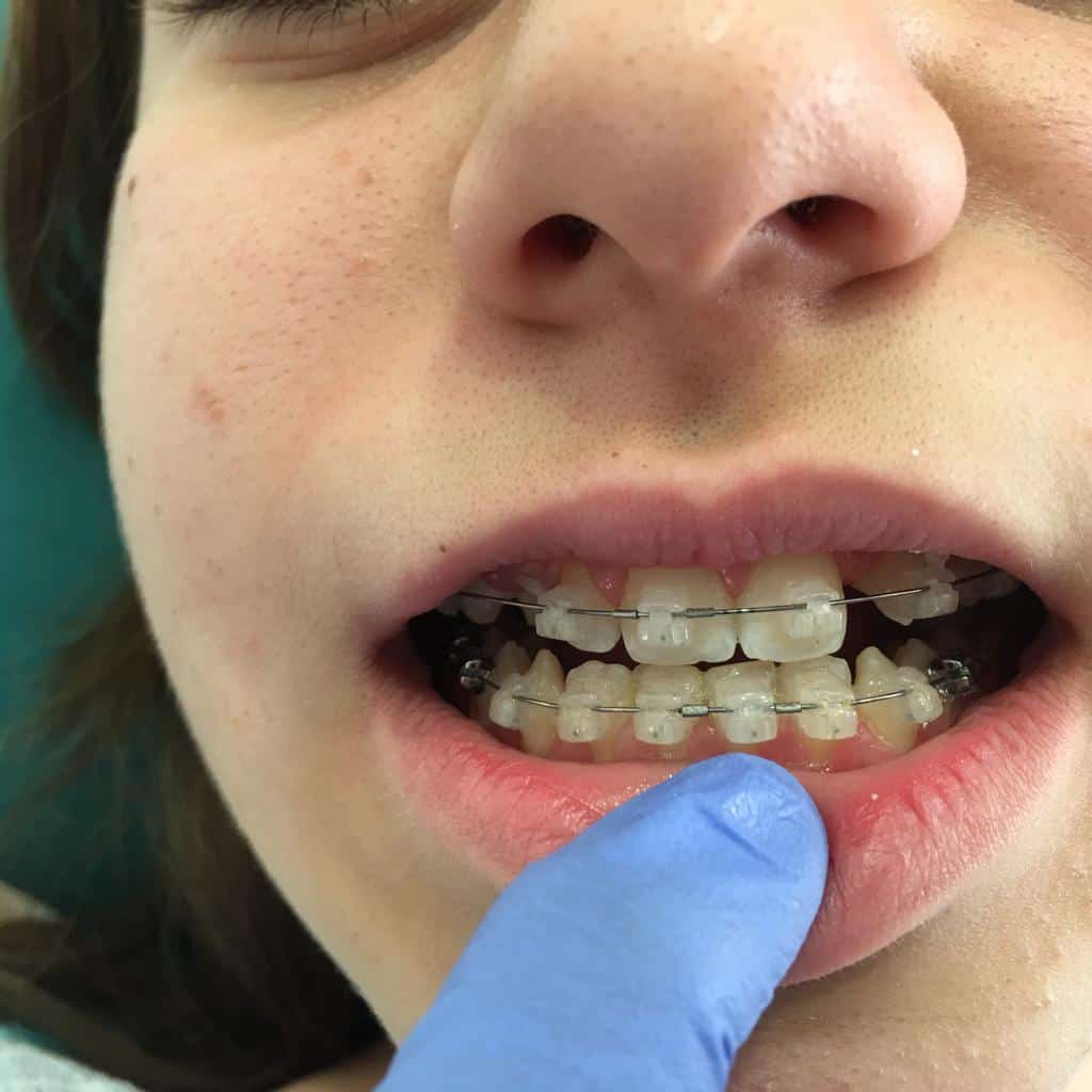 ד"ר נטליה נבייב - יישור שיניים ברמת גן
