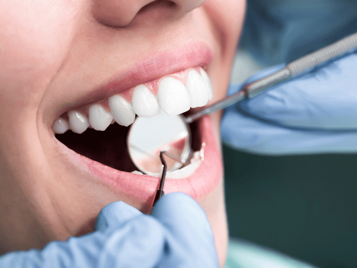 רופאי שיניים מומלצים ברמת גן . צילום אילוסטרציה canva