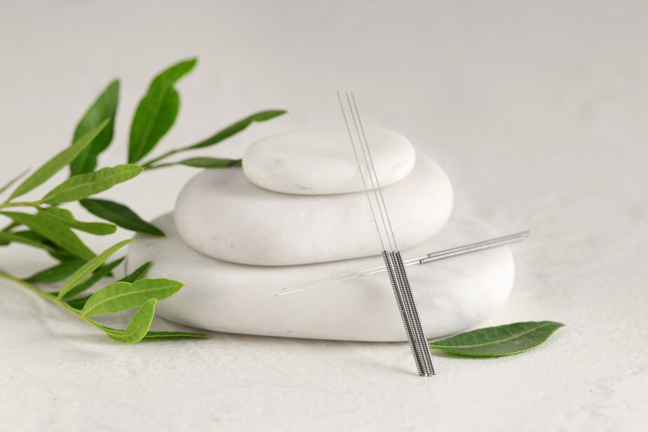 כללית אסתטיקה צילום: shutterstock Acupuncture,Needles,And,Spa,Stones,On,Light,Background